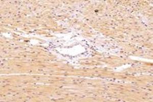 Immunohistochemistry (Paraffin-embedded Sections) (IHC (p)) image for anti-Protein Serine Kinase H1 (PSKH1) antibody (ABIN7075291)