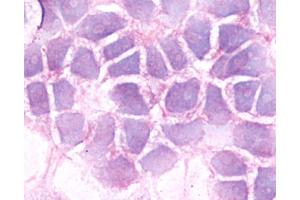 Anti-BDKRB2 / BK-2 antibody immunocytochemistry (ICC) staining of untransfected HEK293 human embryonic kidney cells. (BDKRB2 抗体  (C-Term))