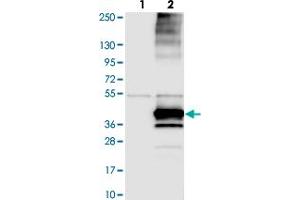 Western blot analysis of Lane 1: Negative control (vector only transfected HEK293T lysate). (KCNK17 抗体)