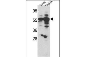 Western blot analysis of hSGKL- (SGK3) (ABIN1882132 and ABIN2842051) in Jurkat and HepG2 cell line lysates (35 μg/lane). (SGK3 抗体  (AA 108-139))