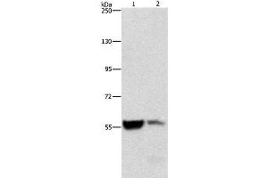 Western Blot analysis of Mouse liver and kidney tissue using ALDH8A1 Polyclonal Antibody at dilution of 1:550 (ALDH8A1 抗体)