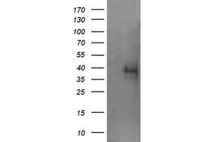 Image no. 2 for anti-Tripartite Motif Containing 44 (TRIM44) antibody (ABIN1501507) (TRIM44 抗体)