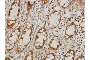 Image no. 1 for anti-Elongator Complex Protein 1 (ELP1) (AA 1242-1332) antibody (ABIN599043) (IKAP/p150 抗体  (AA 1242-1332))