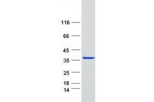 Western Blotting (WB) image for Heme Oxygenase (Decycling) 1 (HMOX1) protein (Myc-DYKDDDDK Tag) (ABIN2722586)