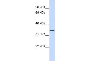 GNPDA1 antibody used at 1 ug/ml to detect target protein. (GNPDA1 抗体  (C-Term))