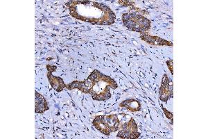 IHC analysis of SARS2 using anti-SARS2 antibody (ABIN7601804). (SARS2 抗体  (AA 46-518))
