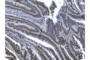 IHC analysis of MCM6 using anti-MCM6 antibody (ABIN7600036). (MCM6 抗体  (AA 14-821))