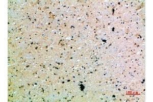 Immunohistochemistry (IHC) image for anti-Platelet-Derived Growth Factor C (PDGFC) (AA 61-110) antibody (ABIN7189516)