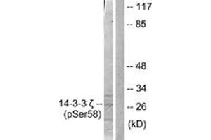 Western blot analysis of extracts from NIH-3T3 cells treated with UV 30', using 14-3-3 zeta (Phospho-Ser58) Antibody. (14-3-3 zeta 抗体  (pSer58))