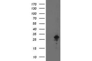 Western Blotting (WB) image for anti-Adenylate Kinase 4 (AK4) antibody (ABIN1496525) (AK4 抗体)
