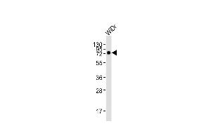 Anti-CD73 (NT5E) Antibody (C-term) at 1:2000 dilution + WiDr whole cell lysates Lysates/proteins at 20 μg per lane. (CD73 抗体)