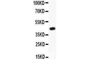 Anti-HIF1 beta Picoband antibody,  All lanes: Anti HIF1 beta  at 0. (ARNT 抗体  (AA 416-789))