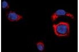 Immunofluorescent analysis of CD226 staining in HeLa cells. (CD226 抗体  (C-Term))
