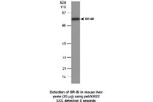 Image no. 1 for anti-Scavenger Receptor Class B, Member 1 (SCARB1) (C-Term) antibody (ABIN363331) (SCARB1 抗体  (C-Term))