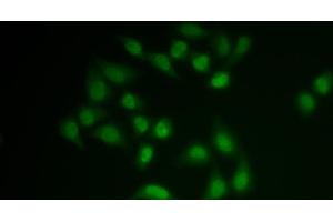 Immunofluorescence analysis of MCF-7 cells using CHAT Polyclonal Antibody (Choline Acetyltransferase 抗体)