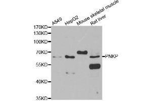 Western blot analysis of extracts of various cell lines, using PNKP antibody. (PNKP 抗体)
