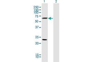 Western Blotting (WB) image for anti-Clusterin (CLU) (AA 402-501) antibody (ABIN560402)