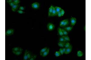 Immunofluorescence staining of HepG2 cells with ABIN7153741 at 1:105, counter-stained with DAPI. (ALG11 抗体  (AA 416-480))