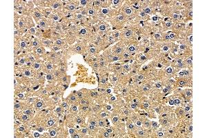 ABIN7096934 and ABIN7101000 at 1/100 staining mouse liver tissue by IHC-P. (PTPLAD2 抗体)