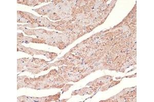 Immunohistochemistry of paraffin-embedded Mouse heart using ADRA1A Polyclonal Antibody at dilution of 1:100 (40x lens). (alpha 1 Adrenergic Receptor 抗体)