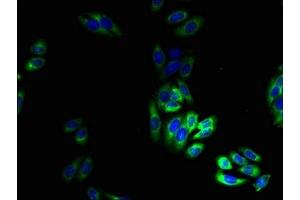 Immunofluorescence (IF) image for anti-Transient Receptor Potential Cation Channel, Subfamily M, Member 2 (TRPM2) (AA 60-119) antibody (ABIN7172859)
