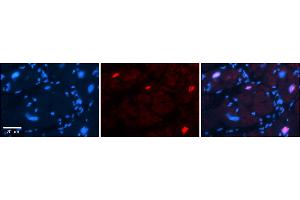 Rabbit Anti-Pou3f3 Antibody  Catalog Number: ARP57888_P050 Formalin Fixed Paraffin Embedded Tissue: Human Adult heart  Observed Staining: Nuclear Primary Antibody Concentration: 1:600 Secondary Antibody: Donkey anti-Rabbit-Cy2/3 Secondary Antibody Concentration: 1:200 Magnification: 20X Exposure Time: 0. (POU3F3 抗体  (C-Term))