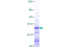Image no. 1 for Mdm2, p53 E3 Ubiquitin Protein Ligase Homolog (Mouse) (MDM2) (AA 101-200) protein (GST tag) (ABIN1310602)