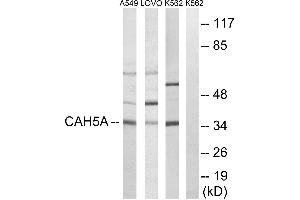 Western blot analysis of extracts from A549 cells, LOVO cells and K562 cells, using CA5A antibody. (CA5A 抗体)