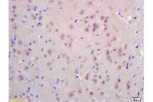 Formalin-fixed and paraffin embedded rat brain labeled with Rabbit Anti CDC45L Polyclonal Antibody, Unconjugated (ABIN873072) at 1:200 followed by conjugation to the secondary antibody and DAB staining