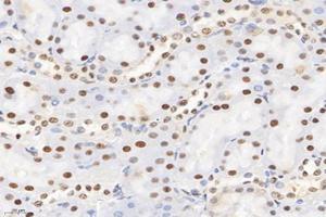 Immunohistochemistry analysis of paraffin-embedded rat kidney using,SET (ABIN7075583) at dilution of 1: 10000 (SET/TAF-I 抗体)