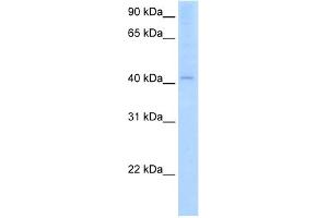 WB Suggested Anti-AADAC Antibody Titration:  2. (AADAC 抗体  (C-Term))