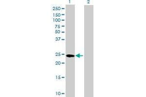 Western Blot analysis of GSTA4 expression in transfected 293T cell line by GSTA4 MaxPab polyclonal antibody. (GSTA4 抗体  (AA 1-222))
