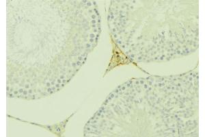 ABIN6277131 at 1/100 staining Mouse testis tissue by IHC-P. (Eppin 抗体  (C-Term))