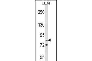 ITGB2 Antibody (N-term) (ABIN1539259 and ABIN2849614) western blot analysis in CEM cell line lysates (35 μg/lane). (Integrin beta 2 抗体  (N-Term))