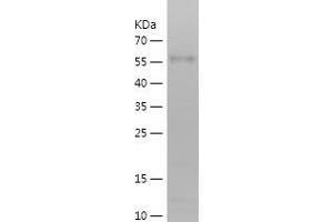 Western Blotting (WB) image for CUB Domain Containing Protein 1 (CDCP1) (AA 24-343) protein (His-IF2DI Tag) (ABIN7122512)