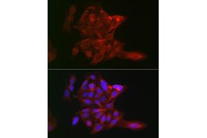 Immunofluorescence analysis of U-2 OS cells using LOX Rabbit pAb (ABIN6133805, ABIN6143288, ABIN6143289 and ABIN6223629) at dilution of 1:100 (40x lens). (LOX 抗体)