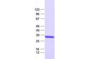 Western Blotting (WB) image for XRCC6 Binding Protein 1 (XRCC6BP1) protein (His tag) (ABIN2735703)