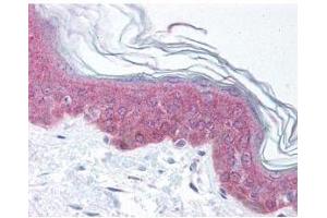 Immunohistochemistry (IHC) image for anti-ArfGAP with SH3 Domain, Ankyrin Repeat and PH Domain 1 (ASAP1) (AA 775-800) antibody (ABIN129669)