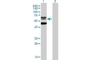 Western Blot analysis of PHF21B expression in transfected 293T cell line by PHF21B MaxPab polyclonal antibody. (PHF21B 抗体  (AA 1-531))