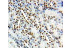IHC-P analysis of Kidney tissue, with DAB staining. (Vitamin D Receptor 抗体  (AA 266-422))