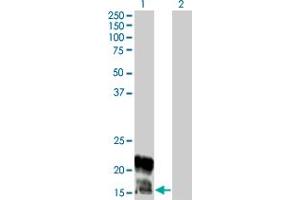Western Blot analysis of KCNE1 expression in transfected 293T cell line by KCNE1 monoclonal antibody (M01), clone 5B12.