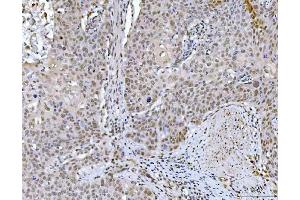 IHC analysis of GLIS1 using anti-GLIS1 antibody (ABIN7599501).