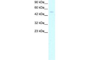 Western Blotting (WB) image for anti-General Transcription Factor IIH, Polypeptide 1, 62kDa (GTF2H1) (N-Term) antibody (ABIN2792595)