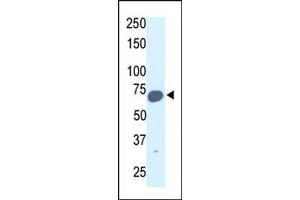 Image no. 1 for anti-Synovial Apoptosis Inhibitor 1, Synoviolin (SYVN1) (C-Term) antibody (ABIN357625) (SYVN1 抗体  (C-Term))