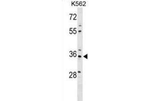 Western Blotting (WB) image for anti-PDZ and LIM Domain 4 (PDLIM4) antibody (ABIN2999859) (PDLIM4 抗体)