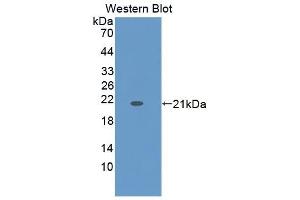 Detection of Recombinant ZG16B, Human using Polyclonal Antibody to Zymogen Granule Protein 16 Homolog B (ZG16B) (ZG16B 抗体  (AA 53-208))
