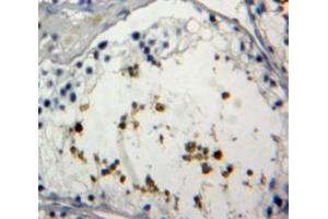 Used in DAB staining on fromalin fixed paraffin-embedded Testis tissue (FOXP1 抗体  (AA 461-671))