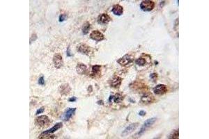 Immunohistochemistry (IHC) image for anti-Kruppel-Like Factor 4 (Gut) (KLF4) (AA 69-101) antibody (ABIN3031572)