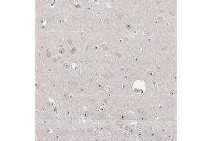 Immunohistochemical staining of human hippocampus with RBM28 polyclonal antibody  shows distinct nucleolar positivity in neuronal cells at 1:50-1:200 dilution. (RBM28 抗体)