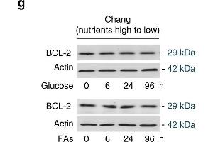 Nutrient induces apoptosis resistance. (Bcl-2 抗体)
